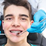 How to Avoid Major Orthodontics