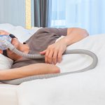 The CPAP Recall and Sleep Apnea Treatment